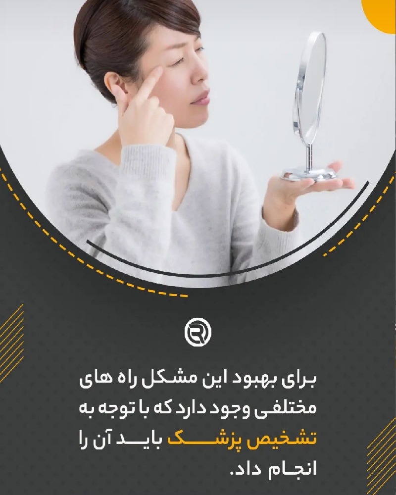 بهترین کولتک اصفهان | بهترین کلینیک لاغری اصفهان | بهترین کلینیک زیبایی اصفهان | درمان خطوط و چروک های اطراف چشم با تزریق مزوژل