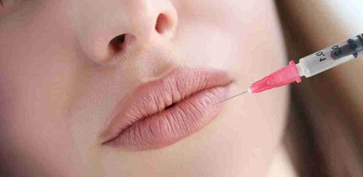 چگونه به لب‌هایی طبیعی و حجیم دست یابیم؟ | بهترین فیلر و بوتاکس اصفهان | کلینیک راشا